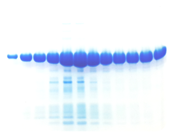 Protein Expression